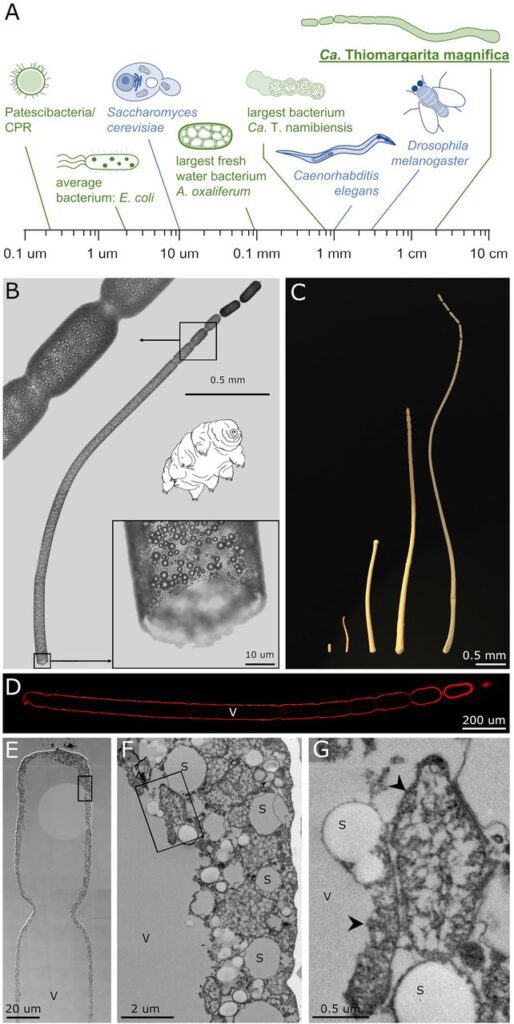 Thiomargarita magnifica: la bacteria más grande jamás descubierta