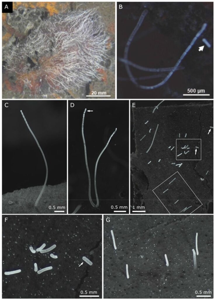 Thiomargarita magnifica: la bacteria más grande jamás descubierta