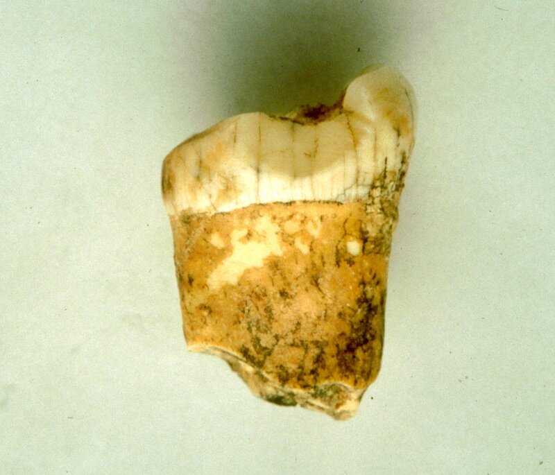 Los neandertales eran carnívoros, sugiere un análisis dental