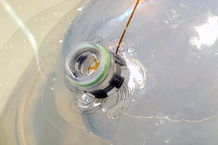 Inyectan Robot en el cráneo para monitorear el cerebro Inyectan Robot en el cráneo para monitorear el cerebro