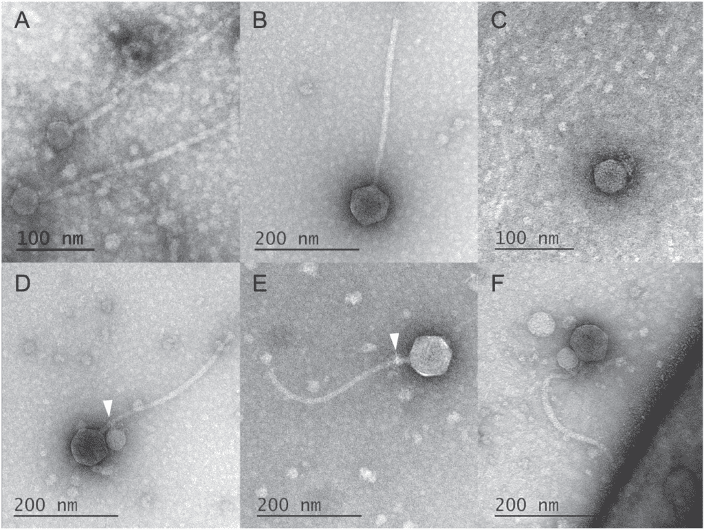 Se ha observado a un virus "parasitando" a otro virus, por primera vez