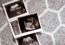 Embarazos a través del sexo anal y otras formas extrañas en que las mujeres pueden quedar encinta Embarazos a través del sexo anal y otras formas extrañas en que las mujeres pueden quedar encinta