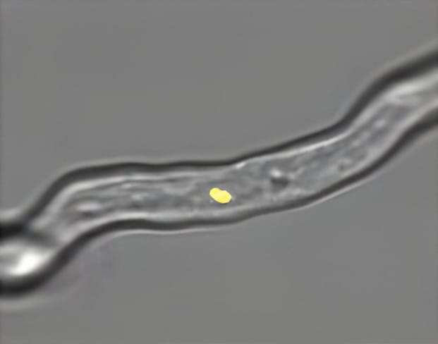 Bacterias insertadas en hongos dan un vistazo de cómo inician las relaciones endosimbióticas Bacterias insertadas en hongos dan un vistazo de cómo inician las relaciones endosimbióticas