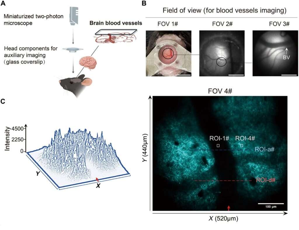 Los microplásticos pueden bloquear el flujo sanguíneo en el cerebro, revela un nuevo estudio