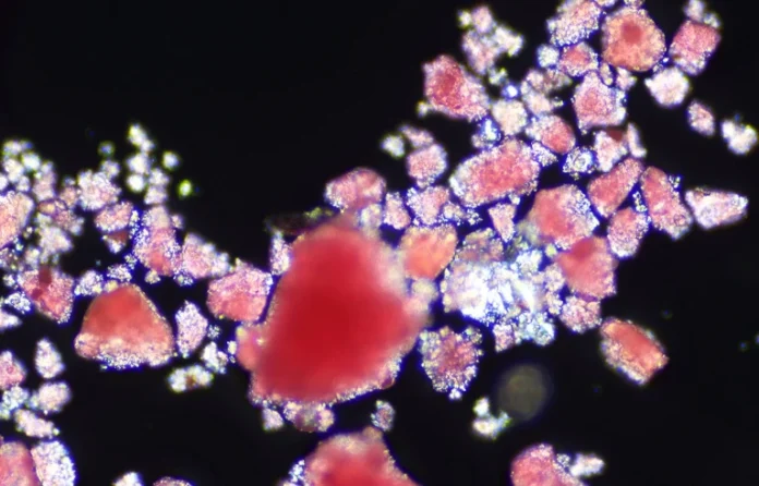 Los microplásticos pueden bloquear el flujo sanguíneo en el cerebro, revela un nuevo estudio Los microplásticos pueden bloquear el flujo sanguíneo en el cerebro, revela un nuevo estudio