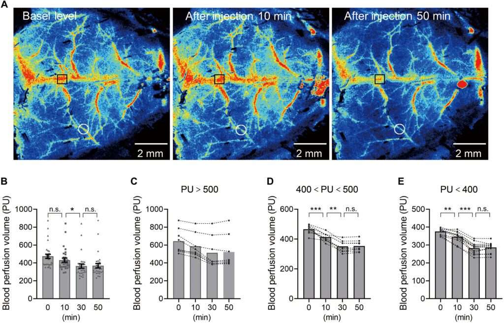 Los microplásticos pueden bloquear el flujo sanguíneo en el cerebro, revela un nuevo estudio