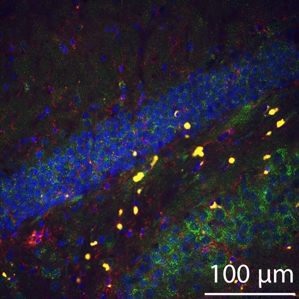 El secreto del cromosoma X: cómo el envejecimiento despierta genes "silenciosos" que podrían proteger el cerebro femenino