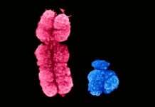 El secreto del cromosoma X: cómo el envejecimiento despierta genes «silenciosos» que podrían proteger el cerebro femenino El secreto del cromosoma X: cómo el envejecimiento despierta genes "silenciosos" que podrían proteger el cerebro femenino